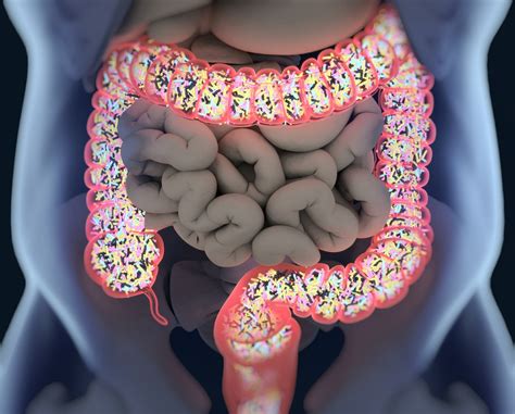 the intestinal permeability test in spondiloarthritis pdf|Intestinal permeability in spondyloarthritis and rheumatoid arthritis .